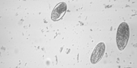 Figure 1. Worm eggs under the microscope
