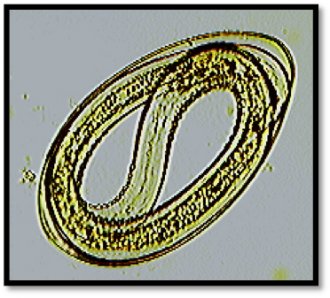 Figure 3a. Nematodirus spp. larvae developed within the egg.