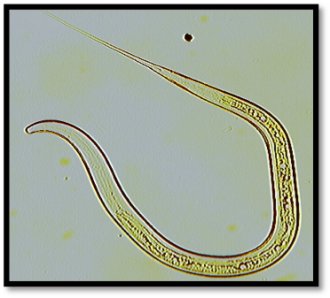 Figure 3b. Nematodirus spp. L3 hatched (100 x magnification). Source: Veterinary Health Research.        