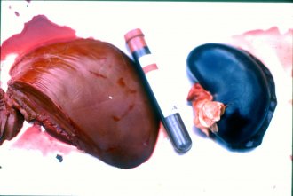 Figure 2. Copper poisoning showing (from left to right) liver, vial of bloody urine, dark kidney. Source: Dr Sandra Baxendell.