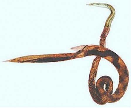 Image: Barber's pole worm (Source: Professor Nick Sangster, University of Sydney)