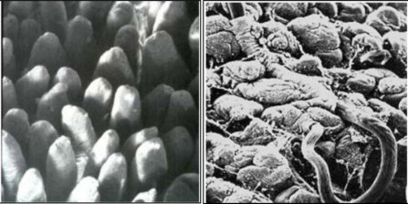 Image: (Left) Normal surface of the small intestine (Right) The wall of the small intestine damaged by black scour worm (Source: Dr Ian Beveridge, University of Melbourne)